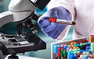 Badania laboratoryjne potwierdziły zakażenie koronawirusem u kolejnych 305 osób, w tym 161 na Śląsku Badania laboratoryjne potwierdziły zakażenie koronawirusem u kolejnych 305 osób, w tym 161 na Śląsku